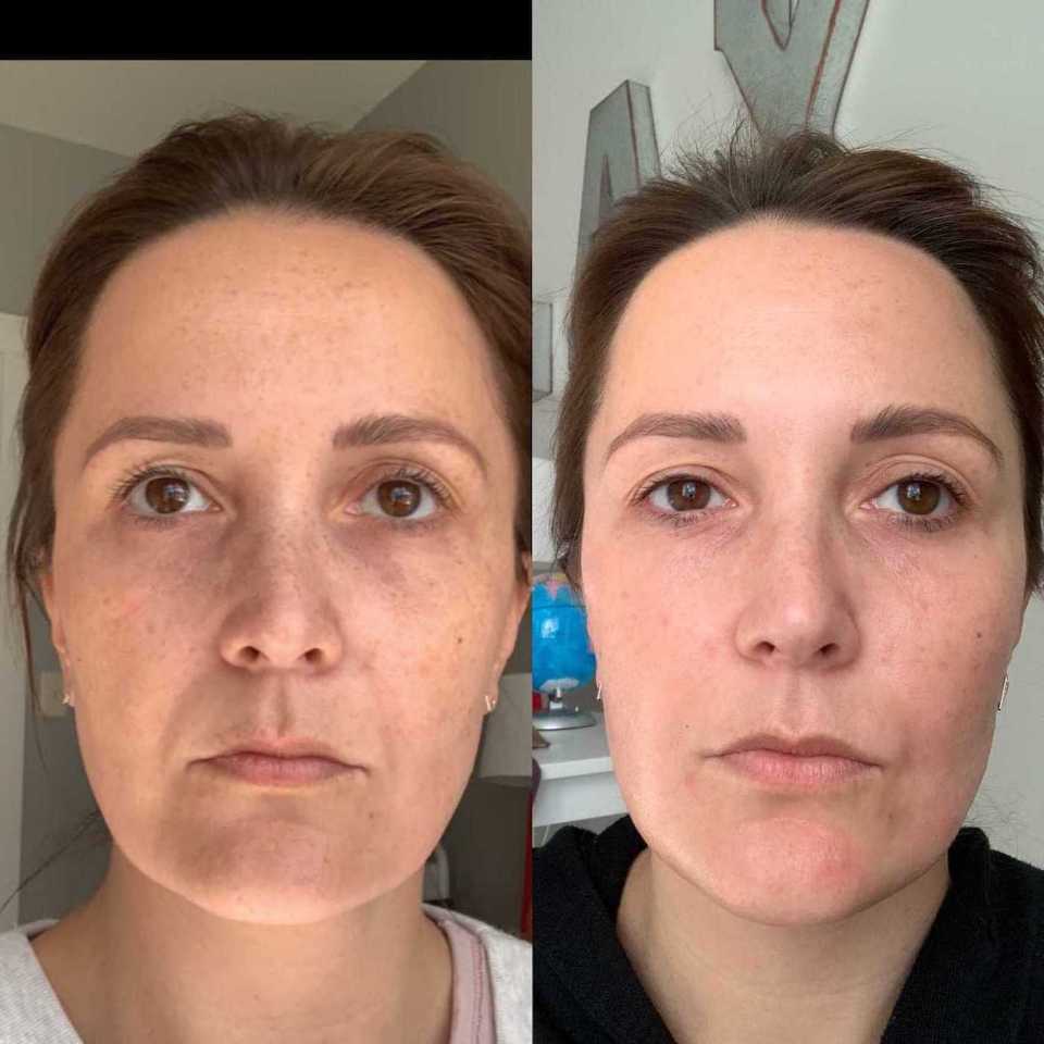 Anti Aging